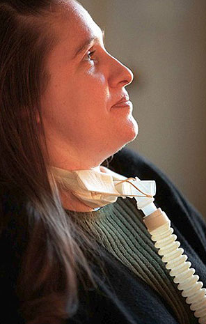 Lisa La Pierre spent 15 years on a ventilator and in a wheelchair. (Robert Gauthier / Los Angeles Times / December 30, 1999)